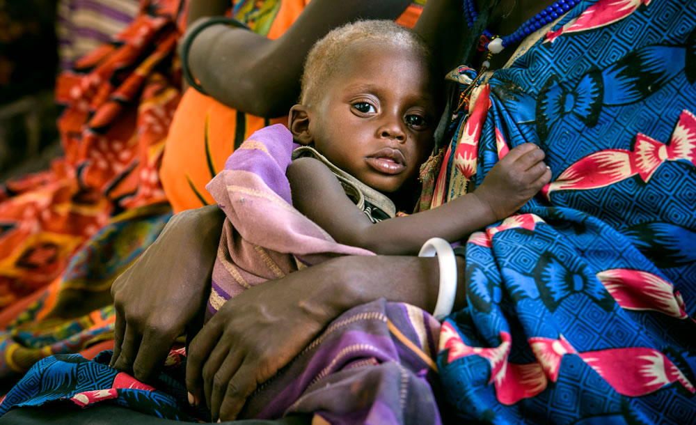 World Vision calls for participation in “Global Day of Prayer to End ...
